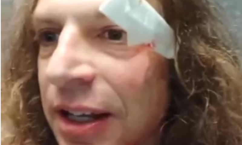 נעצר חשוד בתקיפה של אמיר חצרוני