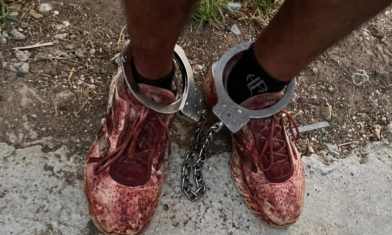 ניסיון רצח בקריית גת: המשטרה פתחה בחקירה