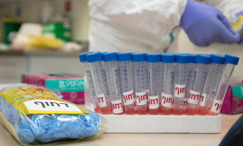 אחוז הבדיקות החיוביות &ndash; הנמוך מזה 3 חודשים