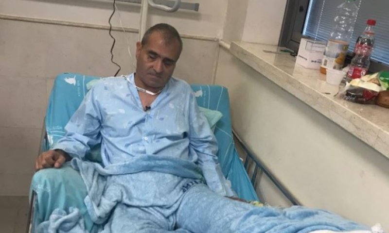 מחדל של רכבת ישראל גרם לעיוור לאבד את כף רגלו