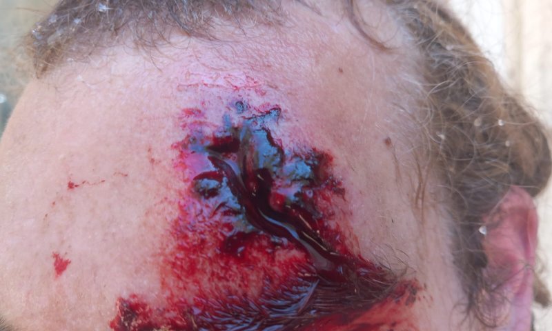 מחבלים הציתו שריפה סמוך לחומש ותקפו מתיישבים