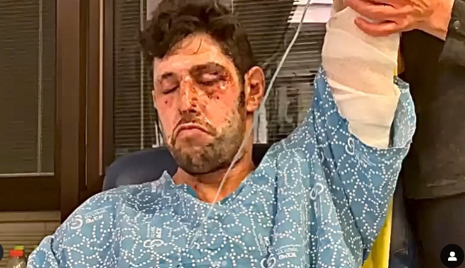 עידן עמדי צילום מסך מתוך אינסטגרם