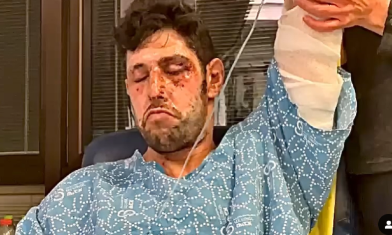 "הכרתי אותה בפאודה": עידן עמדי על האחות שטיפלה בו