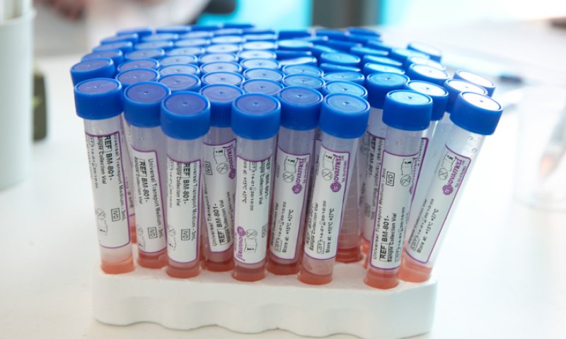 טיפול ניסיוני בהדסה: 5 במצב קשה החלימו מקורונה