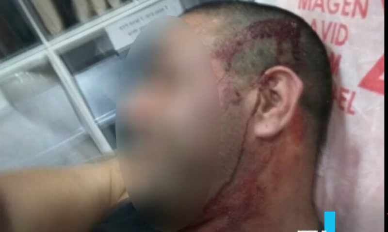 מפחיד: סירב להסיע למצעד הגאווה והותקף קשות. צפו