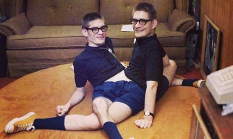 בגיל 68: מתו התאומים הסיאמים המבוגרים ביותר