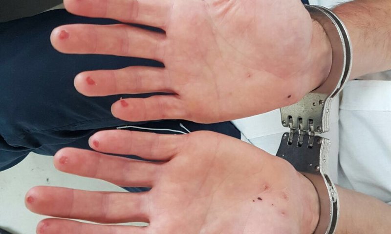 נתפס וחתך את האצבעות כדי למנוע זיהוי. צפו