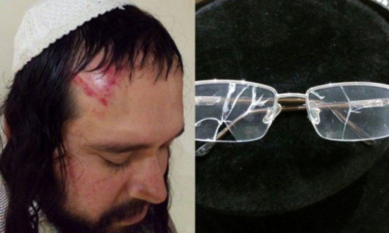 הרב שהתבטא נגד הרב ברלנד חטף מכות באומן