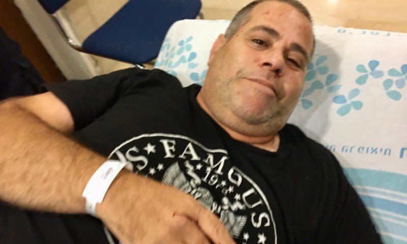 זעזוע מוח ושיניים שבורות: כתב 'ישראל היום' הותקף באלימות קשה