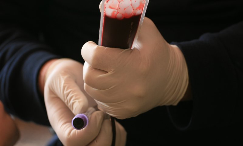 לפני פסח: מד"א מזהיר מפני מחסור חמור בדם