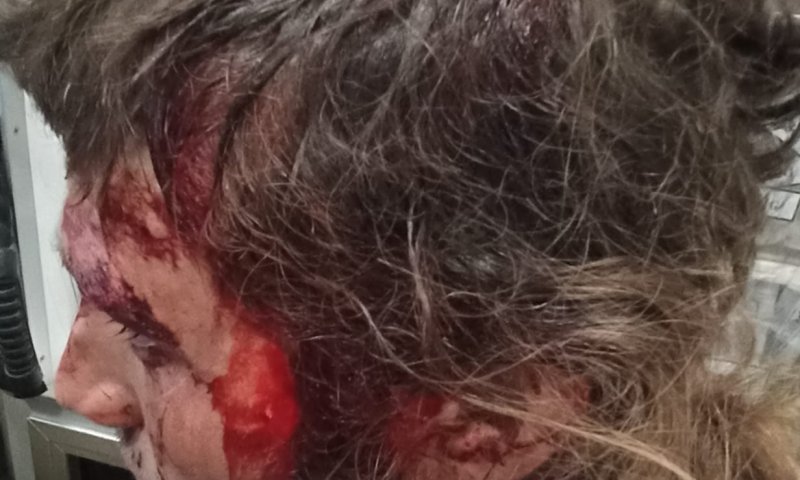 חצי שנה לאחר הלינץ': המחבלים שוחררו לביתם