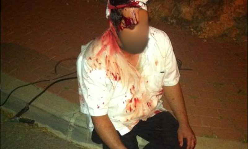 צפו: ישראלי נפצע קשה; הצבא מפנה דווקא את היהודים