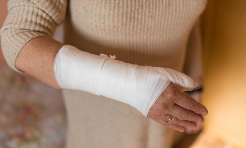 שו"ת: מה עושה אשה שצריכה לטבול ויש לה גבס?