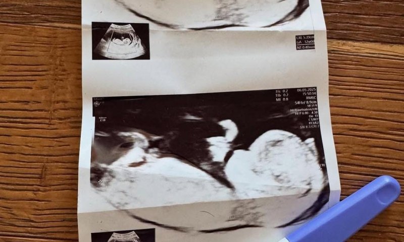 מאמנת הכושר חושפת הפלה: "3 מילים שלא אשכח &ndash; אין דופק, סליחה"