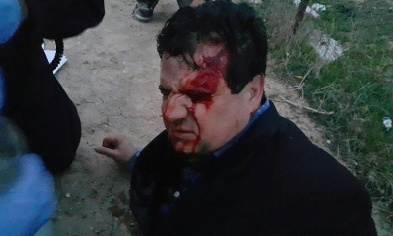 שוטר נרצח בעת פינוי בתים בנגב; ח"כ עודה נפצע