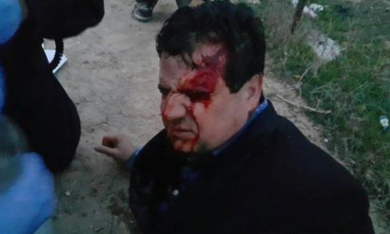 נסגר התיק נגד השוטרים שהתעמתו עם ח"כ עודה