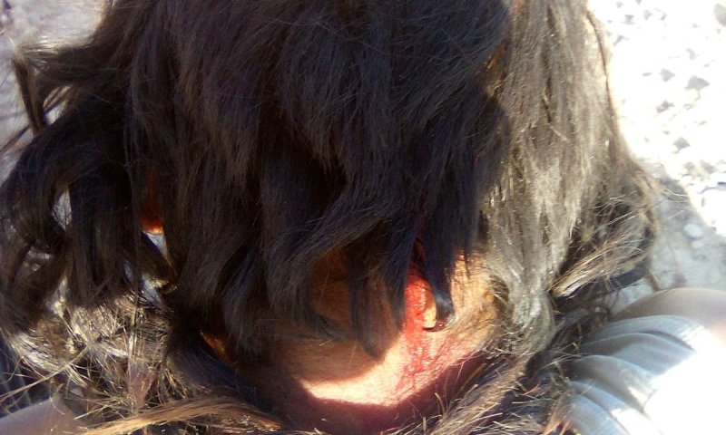 שבת של טרור ביו"ש: ערבים פגעו בבעל חווה ורועה