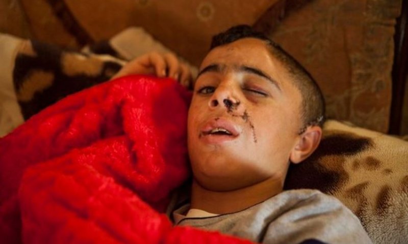 מלחמת גרסאות: איך נפצע בן דודה של עהד תמימי?