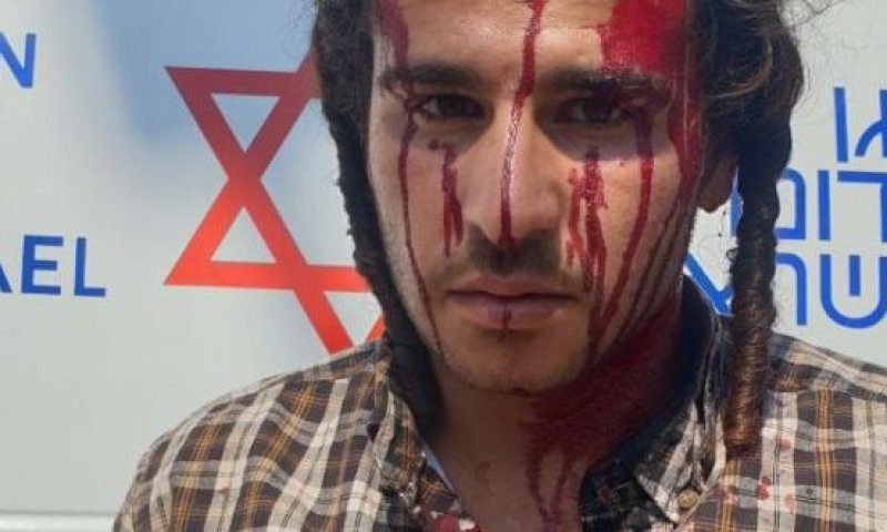 זו גרסת החקלאים שעברו לינץ' בשומרון ונעצרו