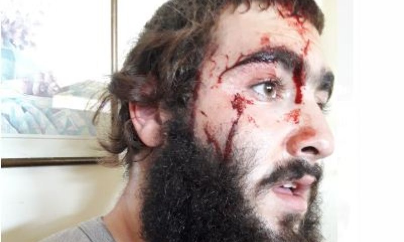 תיעוד: לפני שבת- יהודים עברו לינץ' בצפון