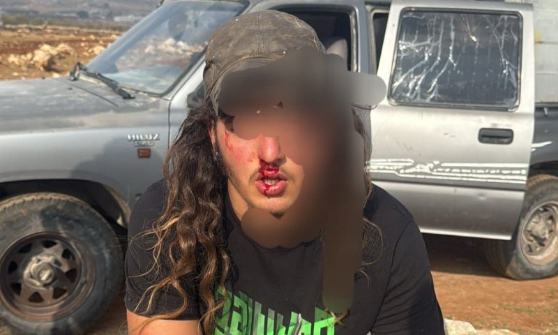 אירוע רודף אירוע: רועה צאן הותקף בבנימין ופונה לבית החולים