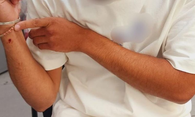 הירי בעיר העתיקה: בימ"ש שיחרר את הלוחם ממעצר