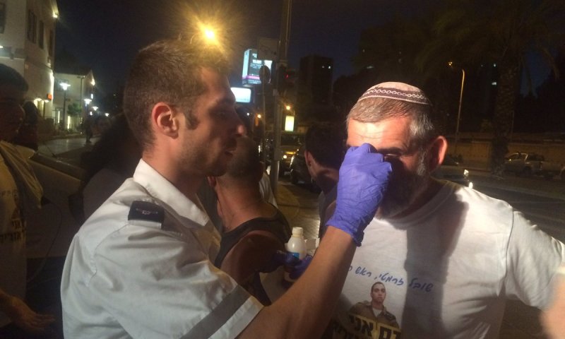 שמאלנים תקפו בחומצה צעדת תמיכה באלאור