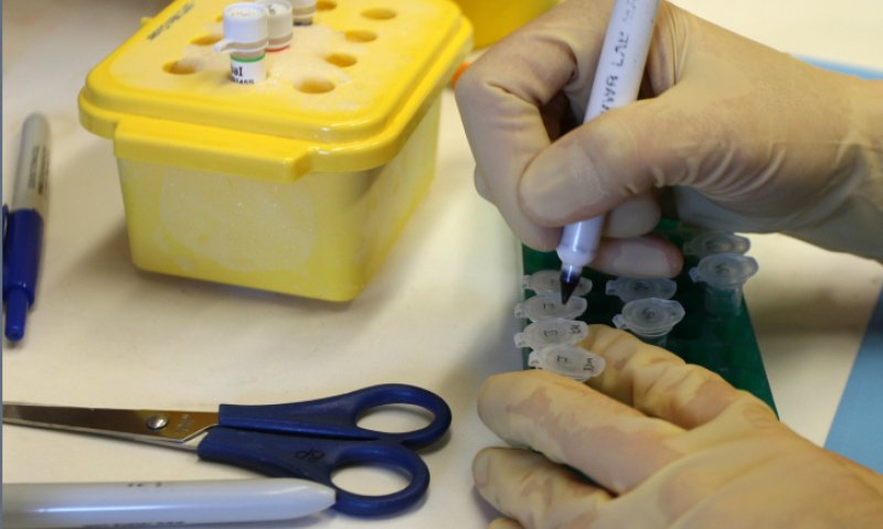 הסיבה לעיכוב בפרסום מספר חולי הקורונה