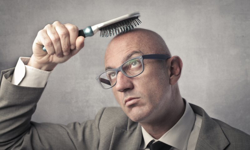 גברים שעושים קרחת עלולים לעבור על איסור דאורייתא