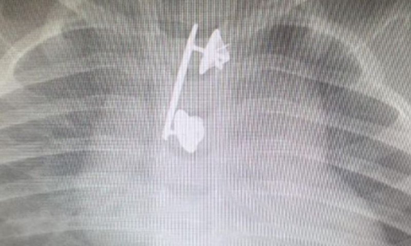 סיכת המ"מ של הקצינה נמצאה בוושת של בנה הפעוט