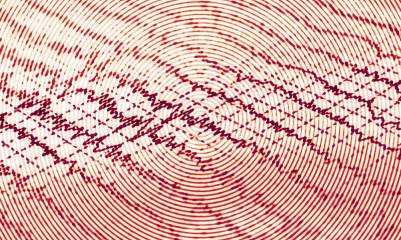 חולה אפילפסיה יכול להוציא רישיון? ● מיתוסים על מחלת הנפילה