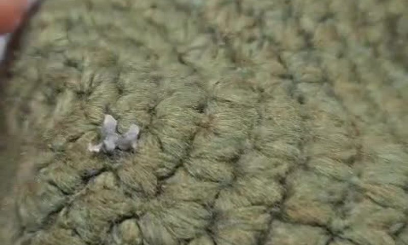 הכיפה עצרה את הרסיס; הפצוע לא נשרט