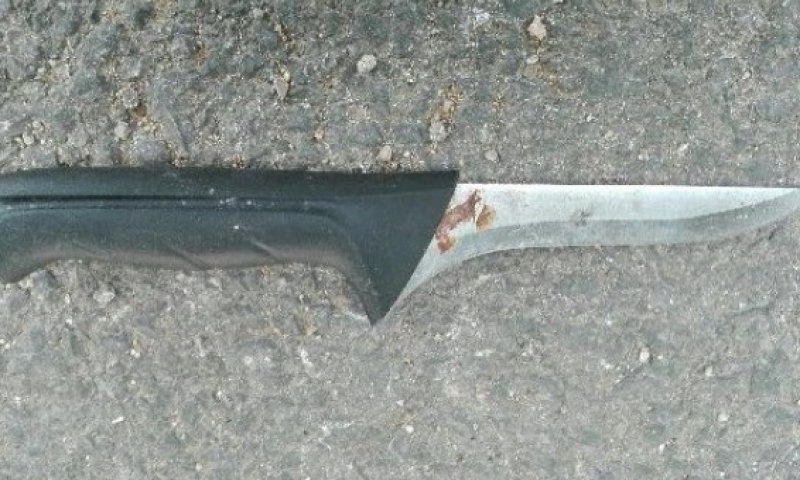 שני שוטרים נפצעו בפיגוע ירי ובפיגוע דקירה