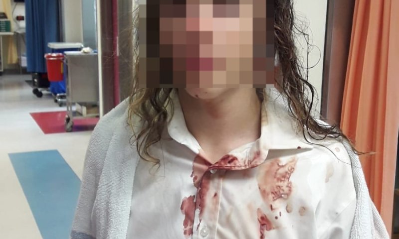 חודש אחרי תקיפת נער באלה: טענות נגד מח"ש בעיכוב החקירה