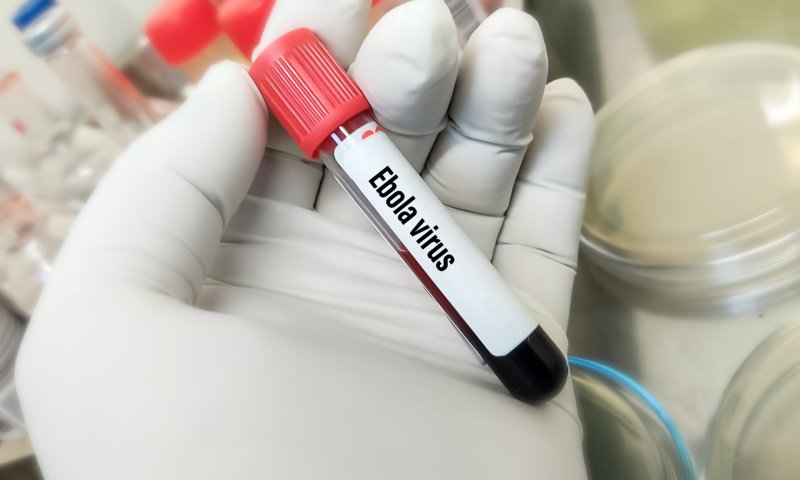 משרד הבריאות: להתכונן למקרה חשוד של אבולה