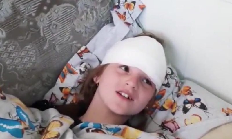 הילדה החרדית משחזרת: "הרגשתי שאני נשרפת"