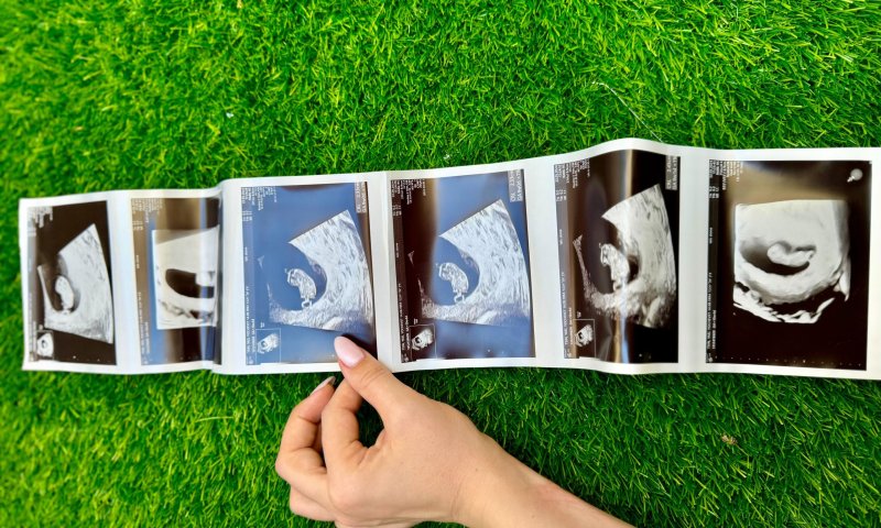 העיתונאית החרדית חושפת: היריון חמישי בגיל 29