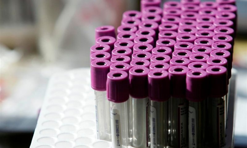 מכון פוע"ה: עוד לא קם הפוסק שיתיר תרומת זרע