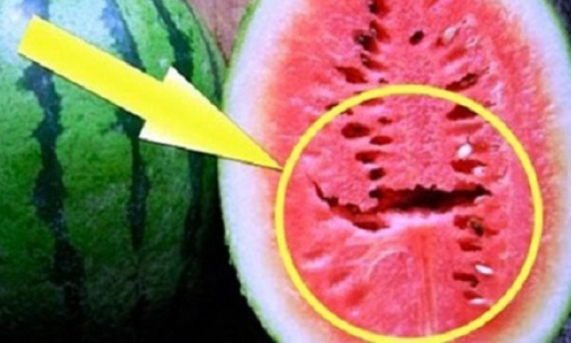 הרשת נסערת בגלל סכנה חדשה ומדאיגה באבטיחים