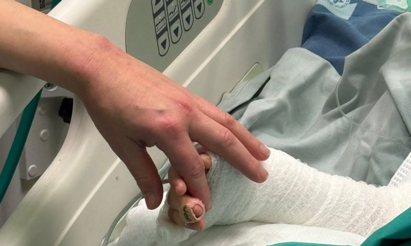 בליל שבת: ילד בן 4 וחצי נפל לסיר רותח בבית כנסת