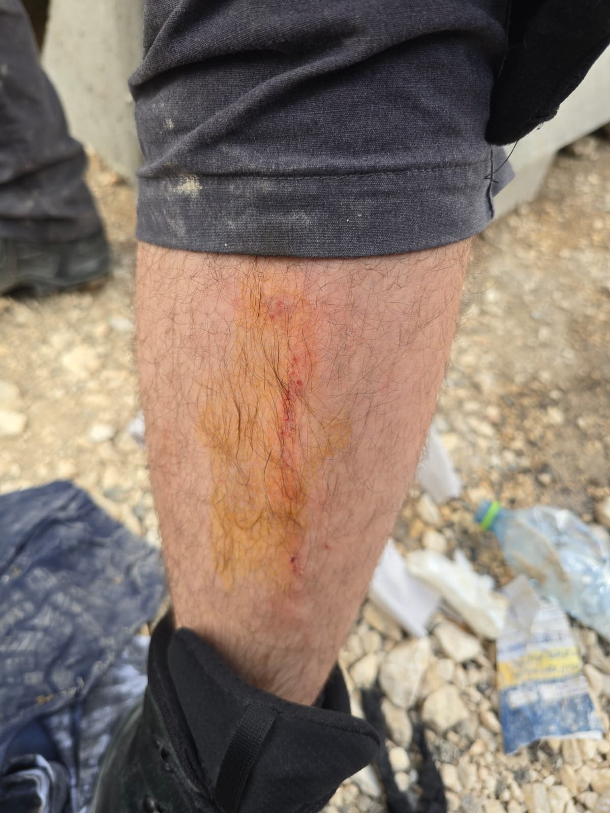 דוברות המשטרה