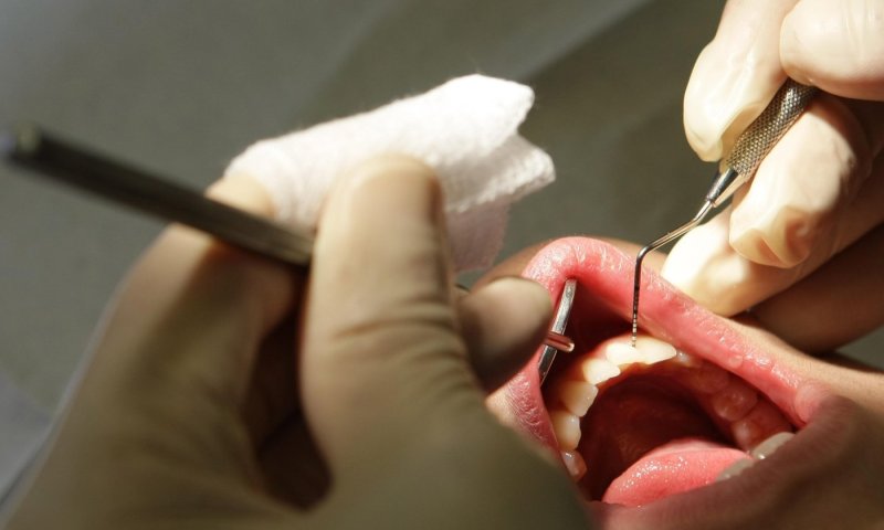 במשך 9 שנים: התחזה לרופא שיניים וגרם נזק אדיר למטופלים