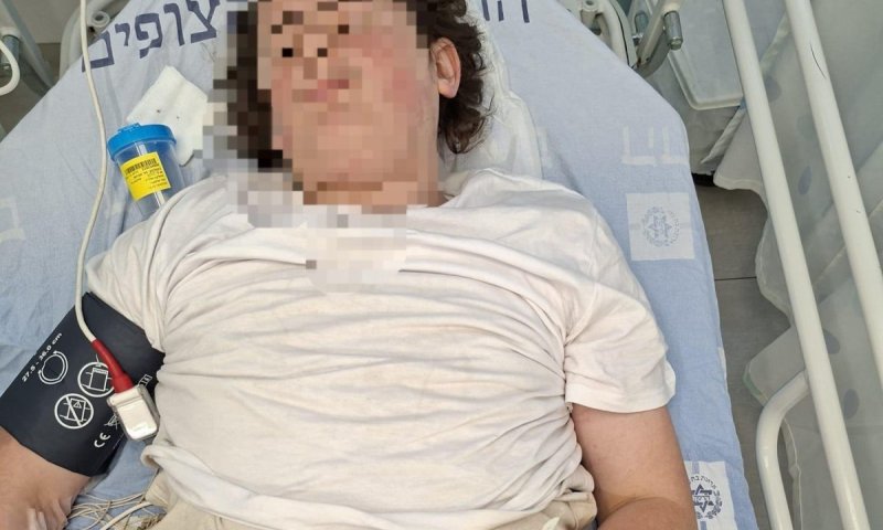 קטין איבד הכרה במהלך חקירה בתחנת הקישלה בירושלים